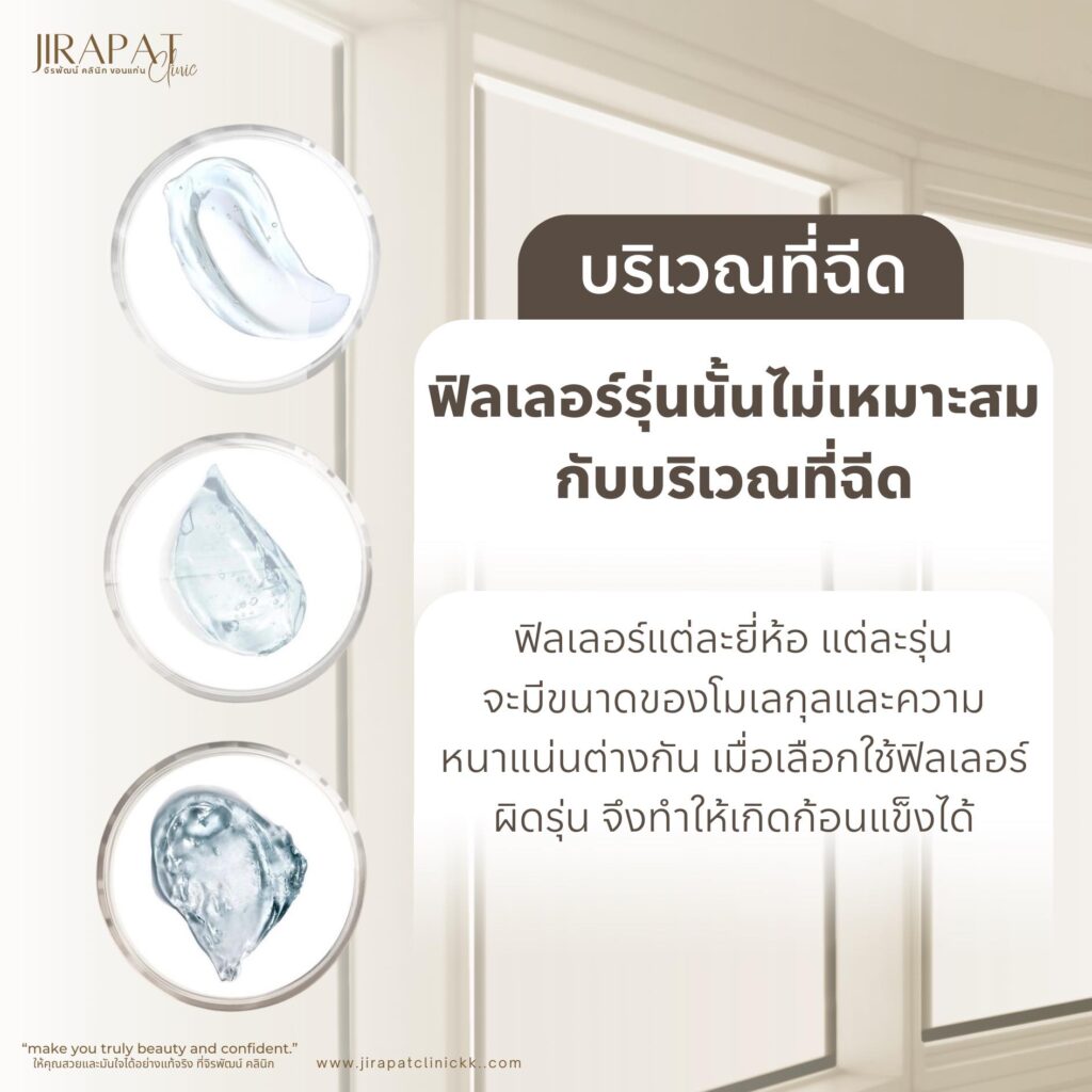 ฟิลเลอร์เป็นก้อน เกิดจากสาเหตุไหนได้บ้าง